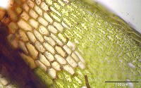 A light micrograph of the leaf of a foliaceous moss (Bryum imbricatum) showing cells with green chloroplasts.