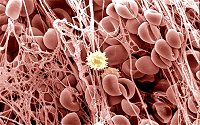 A scanning electron microscope image of a blood clot at high power, showing red blood cells and white blood cells caught in fibrin strands.