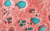 Colorized scanning electron micrograph (SEM) depicting a large grouping of Gram-negative Legionella pneumophila bacteria, taken at a moderately-high magnification of 5000X.